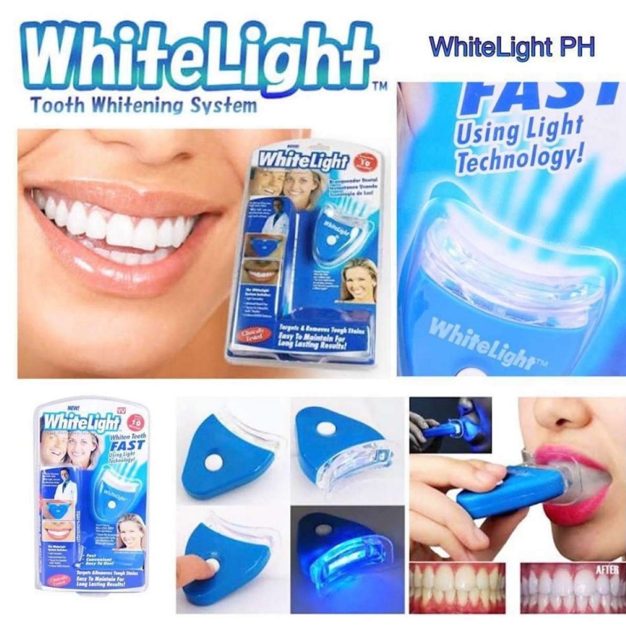 White Light Teeth Whitener Sale Price Buy Online In Pakistan Faroshpk 